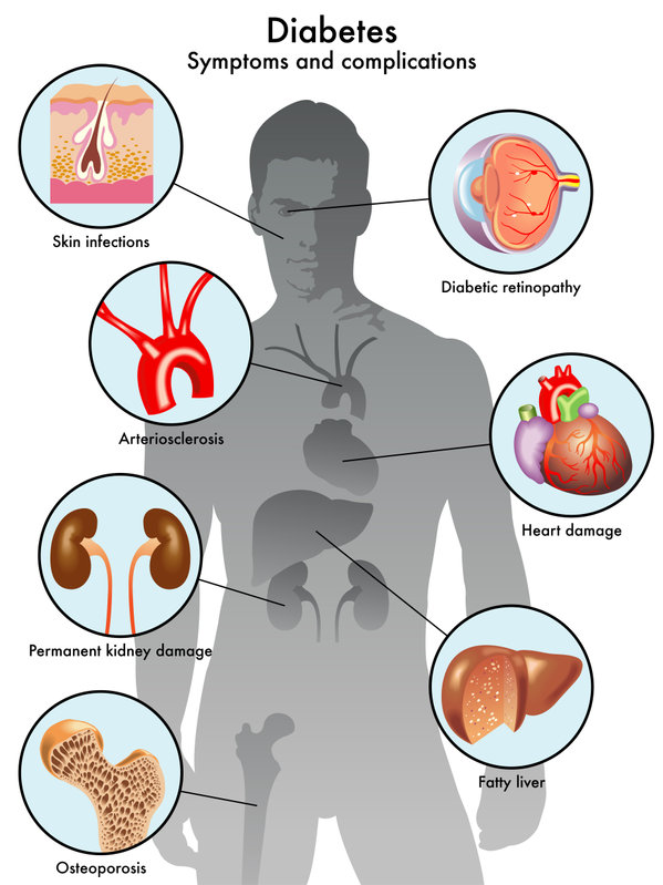 diabetes complication